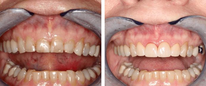 Smile Gallery - Drs. Woodside, Sentz, and Associates